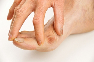 Do I Have a Bunion?