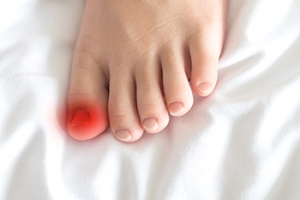 Managing an Ingrown Toenail