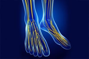 Conditions Associated With Peripheral Neuropathy