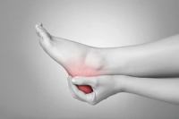 Heel Pain Can Indicate Fat Pad Contusion