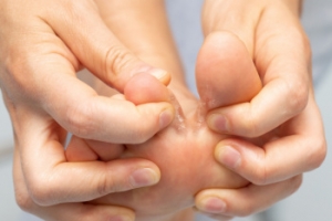 Differentiating Psoriasis From Athlete’s Foot