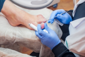 Understanding Ingrown Toenail Surgery